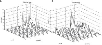 GH Responsiveness in Children With Noonan Syndrome Compared to Turner Syndrome